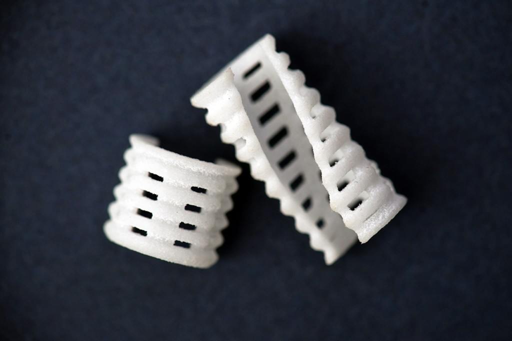 are today alive due to 3D printed stents placed in their airways.