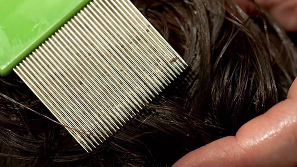 California and 24 Other States in grip of Mutated ‘Super Lice’ attack