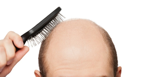 Scientists may have found an early cure for baldness