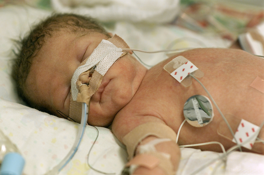Preterm birth linked to traffic jams in new study