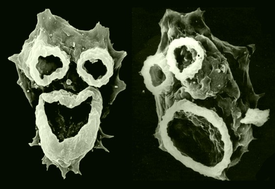 Brain-eating amoeba in Charlotte freshwater claims Ohio teenager